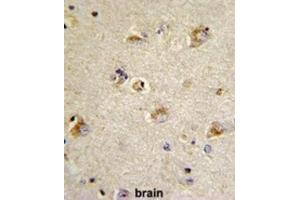 Immunohistochemistry (IHC) image for anti-Cell Division Cycle Associated 3 (CDCA3) antibody (ABIN3002713) (CDCA3 antibody)