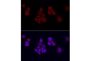 Immunofluorescence analysis of MCF7 cells using MonoMethyl-Histone H3-K27 Rabbit pAb (ABIN3023262, ABIN3023263, ABIN3023264, ABIN1513004 and ABIN6219518) at dilution of 1:50 (40x lens). (Histone 3 antibody  (H3K27me1))