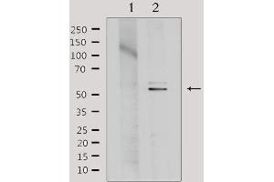 Western blot analysis of extracts from Hela, using TINF2 Antibody. (TINF2 antibody  (Internal Region))