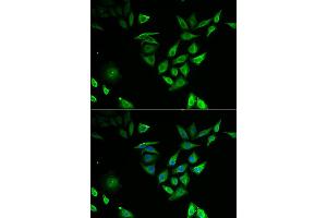 Immunofluorescence analysis of U2OS cell using NUTF2 antibody. (NUTF2 antibody)