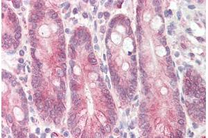 Image no. 2 for anti-Signal Transducing Adaptor Family Member 2 (STAP2) (AA 437-449) antibody (ABIN1492826) (STAP2 antibody  (AA 437-449))