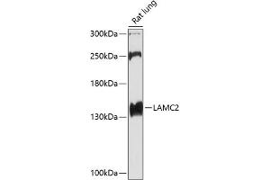 Western blot analysis of extracts of rat lung, using L antibody (ABIN6128174, ABIN6143076, ABIN6143077 and ABIN6219002) at 1:1000 dilution.