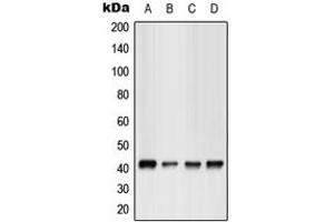 Western blot analysis of GPR17 expression in HEK293T (A), Jurkat (B), NIH3T3 (C), rat kidney (D) whole cell lysates.