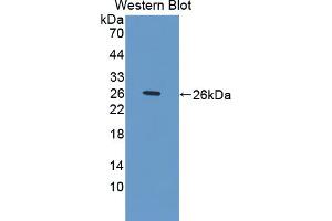 Figure. (NOV antibody  (AA 150-354))