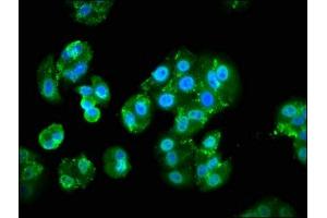 Immunofluorescence staining of HepG2 cells with ABIN7163188 at 1:133, counter-stained with DAPI. (PIK3CA antibody  (Catalytic Subunit alpha))