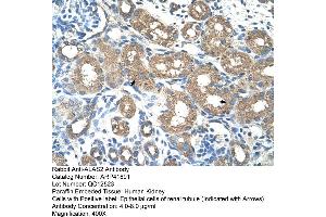 Rabbit Anti-ALAS2 Antibody  Paraffin Embedded Tissue: Human Kidney Cellular Data: Epithelial cells of renal tubule Antibody Concentration: 4. (ALAS2 antibody  (N-Term))