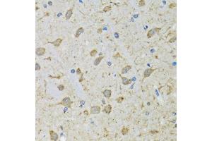 Immunohistochemistry of paraffin-embedded mouse brain using DHRS2 antibody (ABIN5973846) at dilution of 1/100 (40x lens). (DHRS2 antibody)