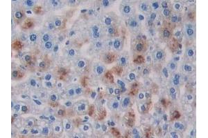 Detection of RIPK3 in Mouse Liver Tissue using Polyclonal Antibody to Receptor Interacting Serine Threonine Kinase 3 (RIPK3) (RIPK3 antibody  (AA 16-239))