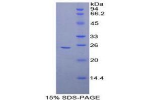 SDS-PAGE analysis of Human Coronin 1A Protein.