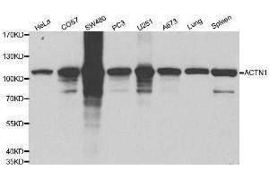 Western blot analysis of extracts of various cell lines, using ACTN1 antibody. (ACTN1 antibody  (AA 1-330))