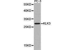Western Blotting (WB) image for anti-Prostate Specific Antigen (PSA) antibody (ABIN1873444) (Prostate Specific Antigen antibody)
