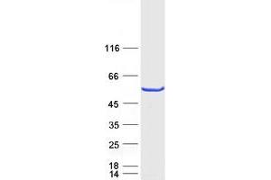Western Blotting (WB) image for RNA-Binding Protein S1 (RNPS1) (Transcript Variant 1) protein (Myc-DYKDDDDK Tag) (ABIN2731058)
