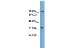 Image no. 1 for anti-NEDD4 Binding Protein 2-Like 2 (N4BP2L2) (AA 647-696) antibody (ABIN6745095) (N4BP2L2 antibody  (AA 647-696))