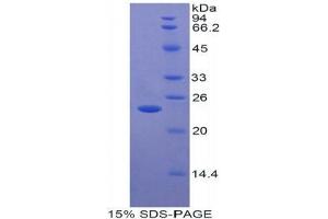 SDS-PAGE (SDS) image for Thymidine Phosphorylase (TYMP) (AA 38-247) protein (His tag) (ABIN2122206)