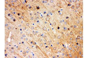 Anti- KCNIP2 Picoband antibody,IHC(P) IHC(P): Mouse Brain Tissue (KCNIP2 antibody  (N-Term))