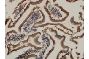 Immunoperoxidase of monoclonal antibody to CIDEB on formalin-fixed paraffin-embedded human small Intestine. (CIDEB antibody  (AA 3-110))