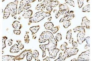 IHC analysis of Cyclophilin E/PPIE using anti-Cyclophilin E/PPIE antibody (ABIN7599242). (PPIE antibody  (AA 1-301))