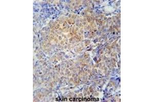 Immunohistochemistry (IHC) image for anti-Serpin Family H Member 1 (SERPINH1) antibody (ABIN2910986) (SERPINH1 antibody)