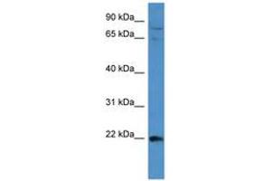 Image no. 1 for anti-Mitogen-Activated Protein Kinase Kinase Kinase 15 (MAP3K15) (AA 1201-1250) antibody (ABIN6743478) (MAP3K15 antibody  (AA 1201-1250))