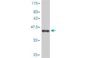 Western Blot detection against Immunogen (43. (BTF3 antibody  (AA 1-162))