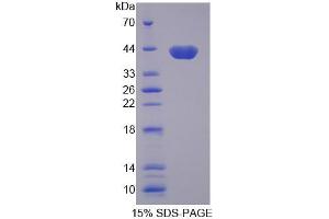 SDS-PAGE (SDS) image for Aquaporin 8 (AQP8) (AA 129-228) protein (His tag,GST tag) (ABIN4989692)