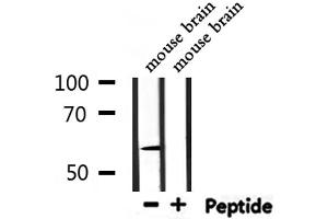 Western blot analysis of extracts from mouse brain, using UGT1A9  Antibody. (UGT1A9 antibody  (C-Term))