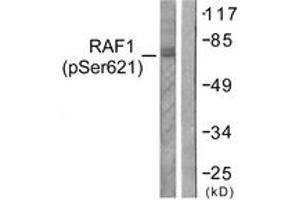 Western blot analysis of extracts from HeLa cells treated with UV 5', using C-RAF (Phospho-Ser621) Antibody. (RAF1 antibody  (pTyr621))
