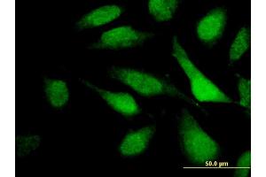 Immunofluorescence of monoclonal antibody to TNRC6C on HeLa cell. (TNRC6C antibody  (AA 181-280))