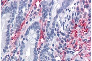 Human Small Intestine: Formalin-Fixed, Paraffin-Embedded (FFPE) (MYOC antibody  (AA 36-135))