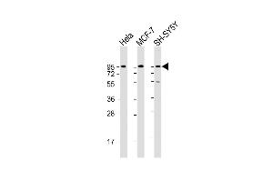 Western Blot at 1:2000 dilution Lane 1: Hela whole cell lysate Lane 2: MCF-7 whole cell lysate Lane 3: SH-SY5Y whole cell lysate Lysates/proteins at 20 ug per lane. (Dystroglycan antibody  (C-Term))