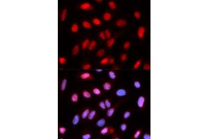 Immunofluorescence analysis of U2OS cells using RFC4 antibody. (RFC4 antibody)