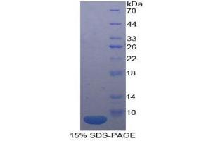 SDS-PAGE (SDS) image for Interleukin 18 Receptor 1 (IL18R1) (AA 375-428) protein (His tag) (ABIN2121435)