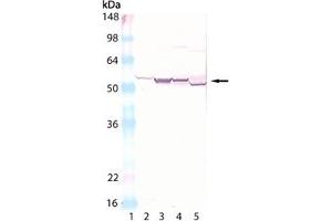 Western blot analysis of Cytochrome P450: Lane 1: MWM, Lane 2: Human Liver microsomes, Lane 3: Rat Liver Microsomes, Lane 4: Mouse Liver Microsomes, Lane 5: Rabbit Liver Microsomes. (Cytochrome P450 antibody)