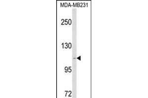 Western blot analysis of CARD6 Antibody (Center) (ABIN1881136 and ABIN2842626) in MDA-M cell line lysates (35 μg/lane). (CARD6 antibody  (AA 755-787))
