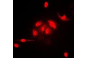 Immunofluorescent analysis of HEMK2 staining in A549 cells.