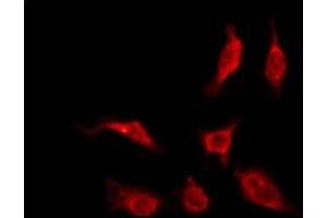 ABIN6276187 staining HeLa by IF/ICC. (OR4K14 antibody  (C-Term))
