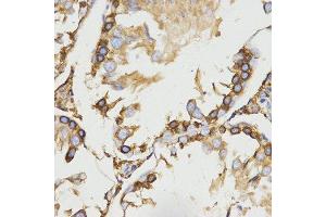 Immunohistochemistry (IHC) image for anti-Low Density Lipoprotein Receptor-Related Protein Associated Protein 1 (LRPAP1) antibody (ABIN1680715) (LRPAP1 antibody)