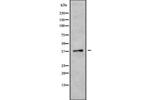 Western blot analysis of CGRRF1 using K562 whole cell lysates (CGR19 antibody  (Internal Region))