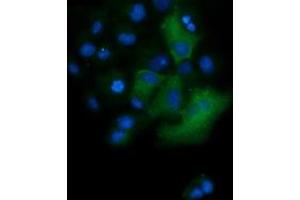 Image no. 3 for anti-Tripartite Motif Containing 38 (TRIM38) (AA 1-265) antibody (ABIN1490682)
