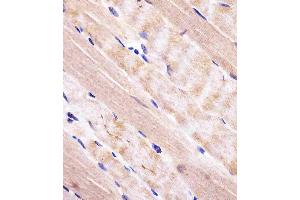 (ABIN652609 and ABIN2842407) staining RAB7 in human skeletal muscle tissue sections by Immunohistochemistry (IHC-P - paraformaldehyde-fixed, paraffin-embedded sections).