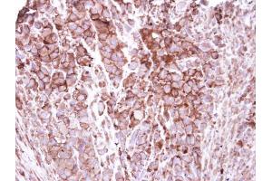 IHC-P Image Immunohistochemical analysis of paraffin-embedded H661 xenograft, using ZO-1, antibody at 1:250 dilution. (TJP1 antibody  (N-Term))