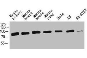 Western Blot analysis of mouse-kidney mouse-heart mouse-brain mouse-lung Hela KB SH-SY5Y cells using HSP70 Polyclonal Antibody diluted at 1:2000. (HSP70 1A antibody  (AA 561-610))