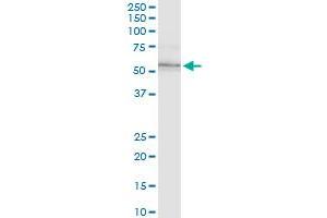 ILK monoclonal antibody (M01), clone 4F10.