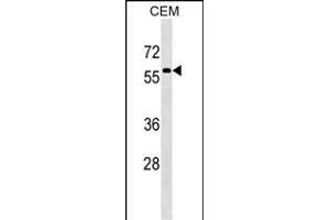 MSL3 Antibody (N-term) (ABIN1539253 and ABIN2849308) western blot analysis in CEM cell line lysates (35 μg/lane).