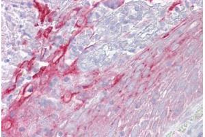Anti-CFP / Properdin antibody IHC staining of human tonsil. (CFP antibody  (AA 35-84))