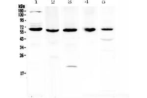 Western blot analysis of TRAF3 using anti-TRAF3 antibody . (TRAF3 antibody  (AA 298-551))