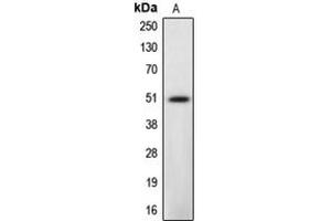 Western blot analysis of Caspase 12 expression in L929 (A) whole cell lysates. (Caspase 12 antibody  (Center))