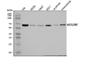 Western blot analysis of IRBIT/AHCYL1 using anti-IRBIT/AHCYL1 antibody (ABIN7600030).
