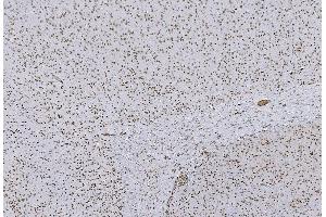 IHC analysis of HP1 alpha/CBX5 using anti-HP1 alpha/CBX5 antibody (ABIN7599057). (CBX5 antibody  (AA 1-191))