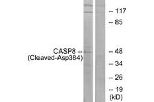 Western blot analysis of extracts from 293 cells, treated with etoposide 25uM 1h, using Caspase 8 (Cleaved-Asp384) Antibody.